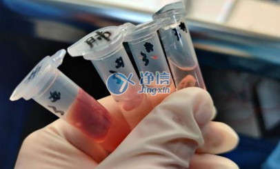 凈信全自動樣品快速研磨儀|浙二醫(yī)院動物內臟組織研磨